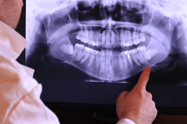 Best Pediatric Emergency Dentist in Canutillo, TX